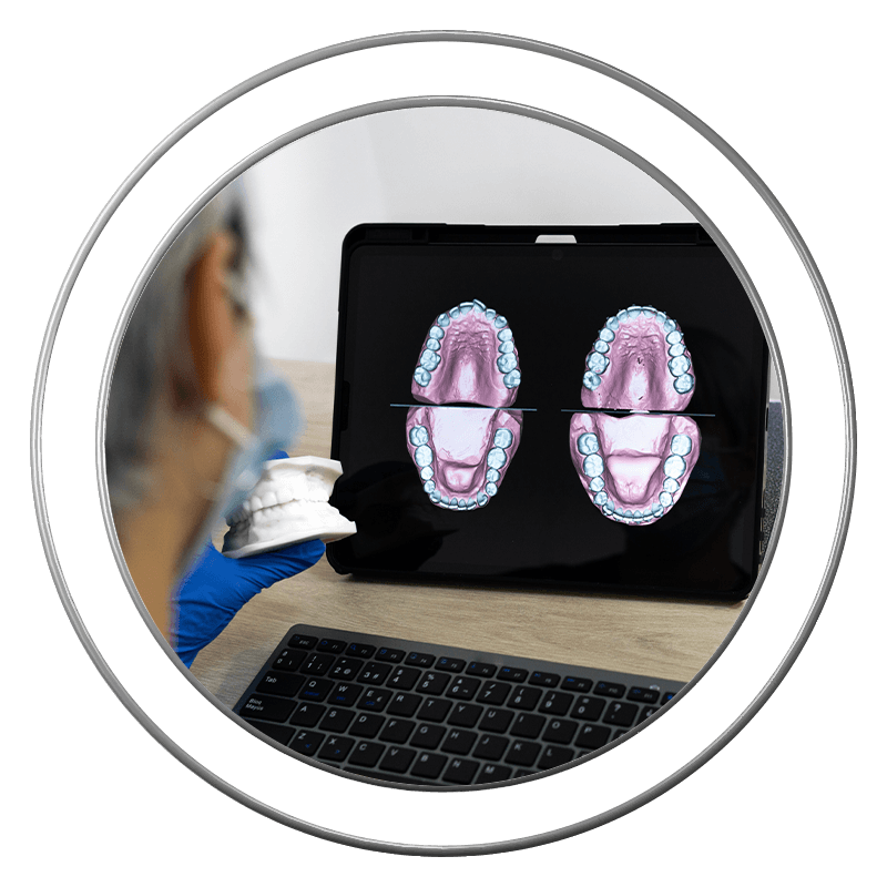 3d scan of teeth on ipad