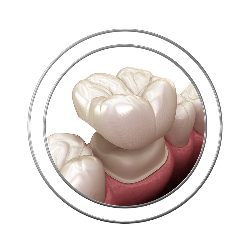 dental crowns stylized