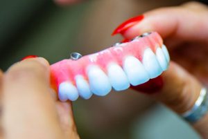 implant supported denture model.