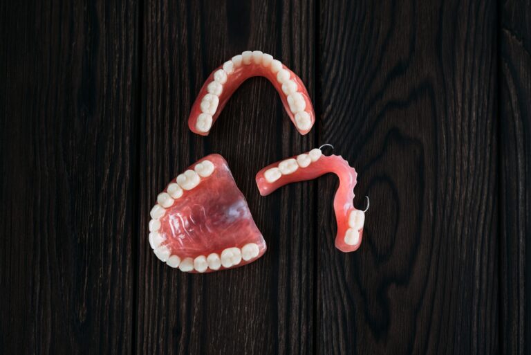 All-on-4 and All-on-6 dental implant models comparison at JP Prosthodontics in Fullerton, CA