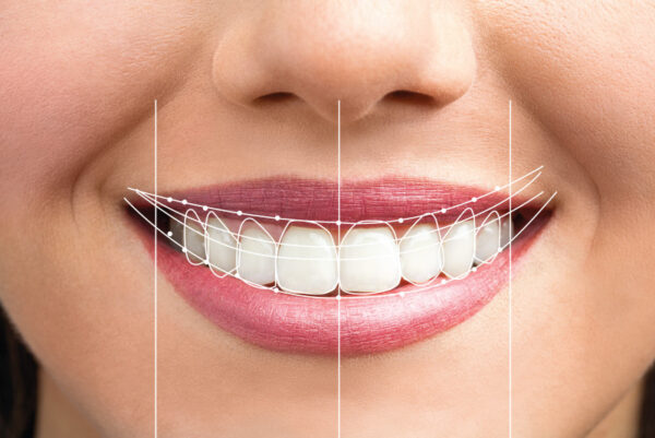 Prosthodontist in Fullerton
